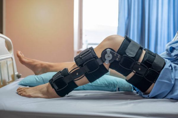 From Hospital to Home What to Expect After Knee Surgery From Hospital to Home What to Expect After Knee Surgery